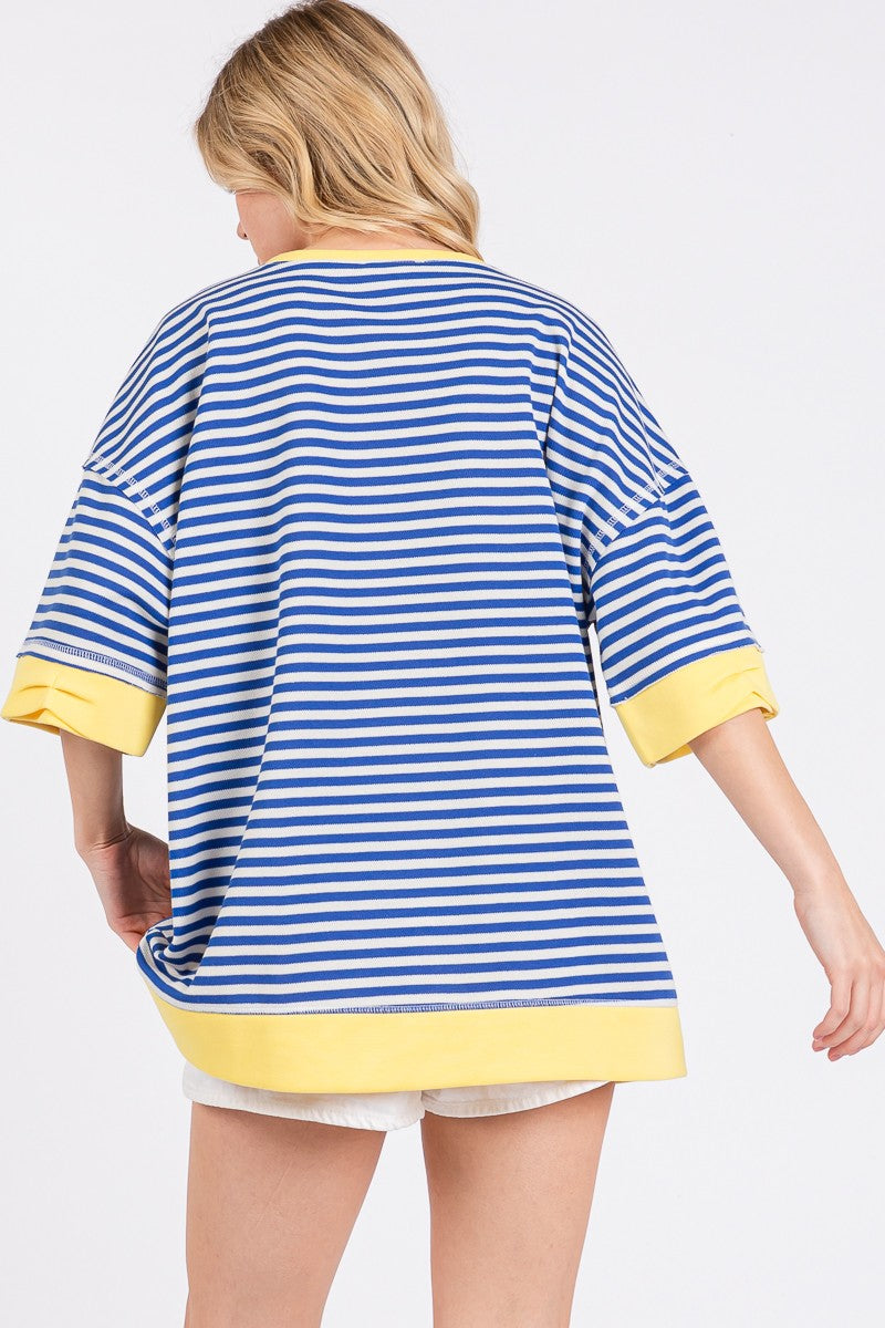 Striped Oversized Short Sleeve Top